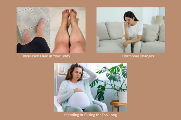 What Causes Foot Swelling in Pregnancy?