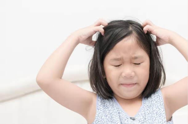 Dandruff in Children